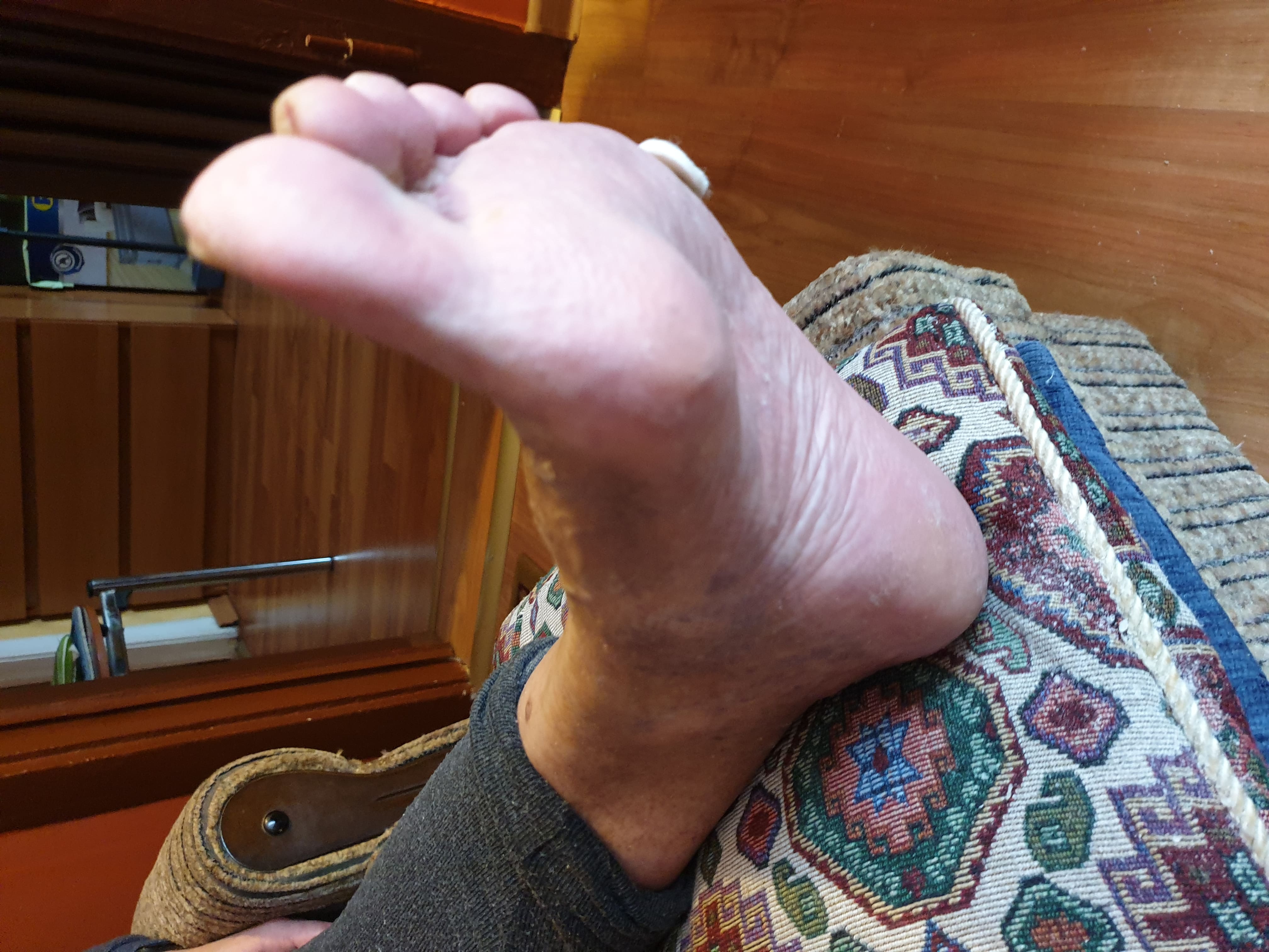 Paznokcie po zabiegu podologicznym — efekt końcowy